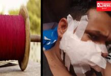 જાણો: ક્યાં પતંગના દોરાથી એક યુવાનના ગાલ-હોઠ કપાયા, આવ્યા 15 ટાંકા