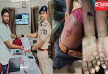 ડાંગના 8 યુવાનો ઢોર માર મારનારા પોલીસ વિરુદ્ધ કડક પગલાં લેવા ધરમપુરમાં અપાયું આવેદનપત્ર: કલ્પેશ પટેલ આક્રોશમાં..