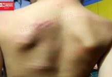 શિક્ષકાના સ્વરૂપમાં સૈતાન.. શિક્ષણની ગરિમા બાજુએ મૂકી 5 વર્ષના માસુમ બાળકને માર્યો ઢોર માર..