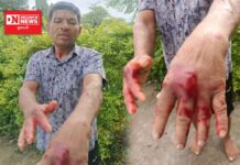 મહુવાના વહેવલમાં ખેતરે જતા ખેડૂત પર દીપડો હુમલો.. કરી ભાગ્યો, ફરી તરાપ મારી..