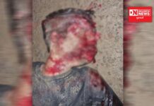 સેલવાસના રખોલીમાં હિટ એન્ડ રનમાં અજાણ્યા વ્યક્તિનું મોત..