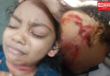 વાંસદાના મોટી વાલઝર ગામે દીપડાનો આતંક, 10 વર્ષીય બાળકી પર હુમલો કર્યો, ગળા પર ઊંડા ઘા..