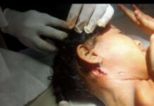 વાંસદા તાલુકા ની ફરીબીજી વાર બની ઘટના ઉપસળ ગામે દીપડાએ બાળકી પર જીવલેણ હુમલો..