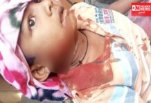 વાંસદાના આંબાબારી ગામે કુદરતી હાજતે ગયેલા બાળક પર દીપડાનો હુમલો.. માંથા અને ગાલના ભાગે ગંભીર ઈજા, 6 ટાંકા..