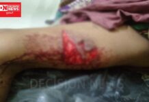 વાંસદાના વાંદરવેલા ગામમાં ઘર આંગણે એક મહિલા પર જંગલી ભૂંડનો હુમલો.. ગંભીર રીતે ઘાયલ મહિલા