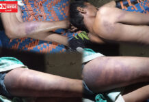 ઝઘડિયાના ધારોલી ગામે ખેતરમાંથી ડુંગરી ચોરી હોવાનો આરોપ કરી બે ઇસમોએ ગામના એક યુવકને માર માર્યો.. જાનથી મારી નાંખવાની ધમકી આપનાર બે ઇસમો સામે ફરિયાદ