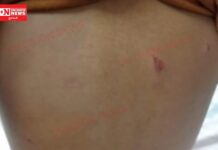 ખેરગામના બહેજ ઝરા ફળિયામાં દીપડાએ નાની બાળકી પર હુમલો, બાળકી ઈજા, વલસાડ પંથકમાં ભારે ભયનો માહોલ..