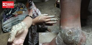 આશ્રમશાળાની બેદરકારીથી વીજ કરંટ લાગતા ધો. 9 ની આદિવાસી વિદ્યાર્થિની ગંભીર ઘાયલ: કેમ રહી સારવાર અધૂરી ?